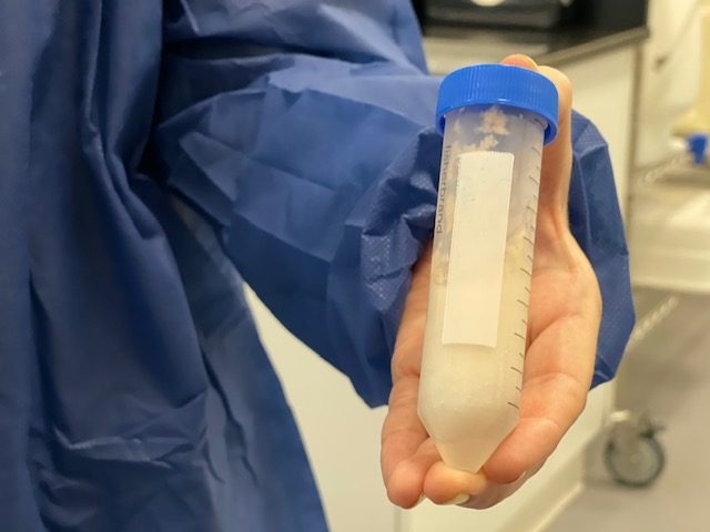 A vial of fungus, straight from a cooler. This is where the products originate for both the Nature's Fynd food company and Hydefy materials startup.